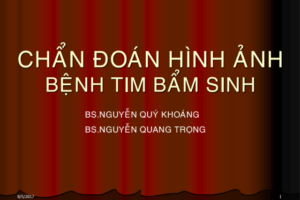 chan-doan-benh-tim-bam-sinh-1