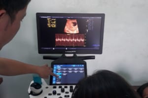 lap-may-sieu-am-doppler-4d-vinno-e20-cho-bs-khanh-kontum
