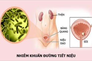 nhiem-khuan-duong-tieu