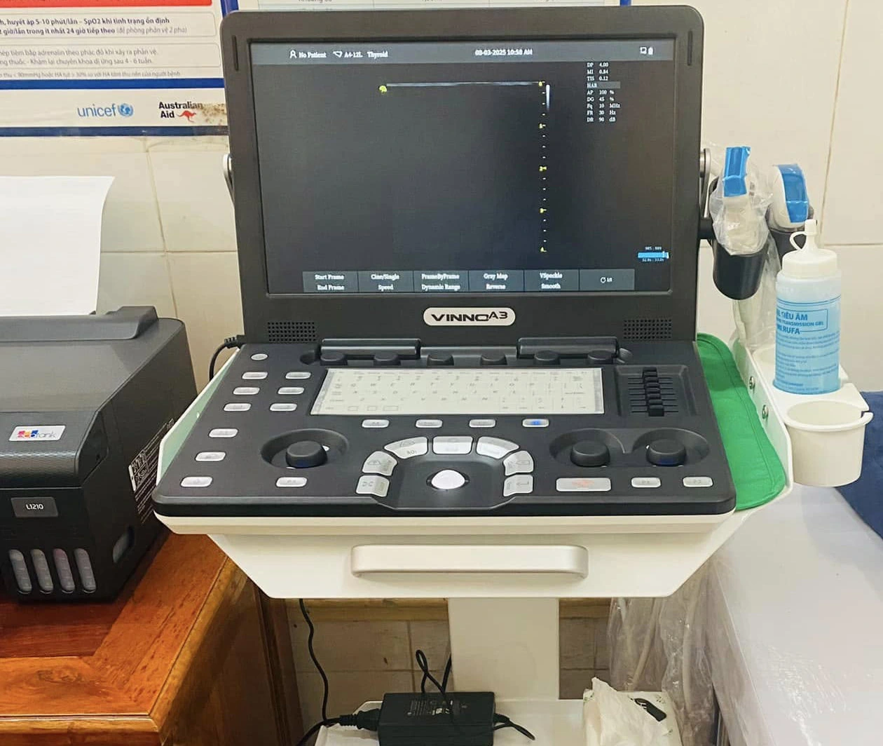 lắp máy siêu âm xách tay Vinno A3 cho bác sĩ tại Đồng Tháp