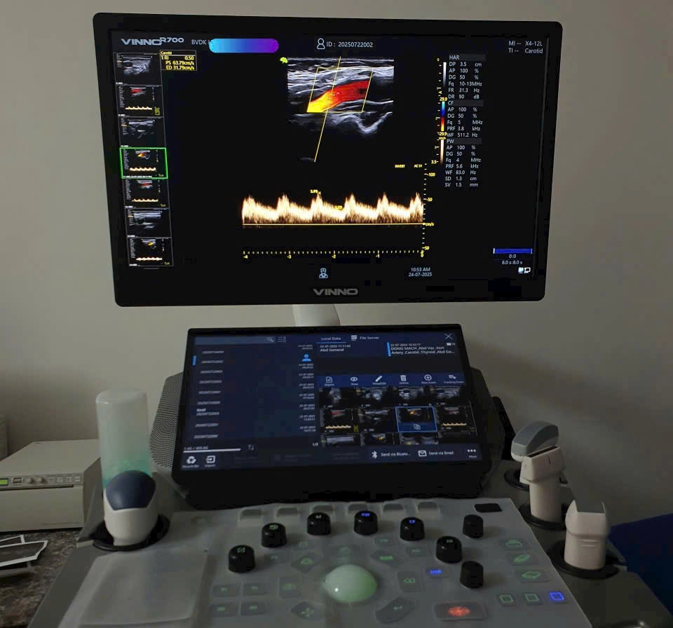 bàn giao máy siêu âm đàn hồi Vinno R700 tại Quảng Bình