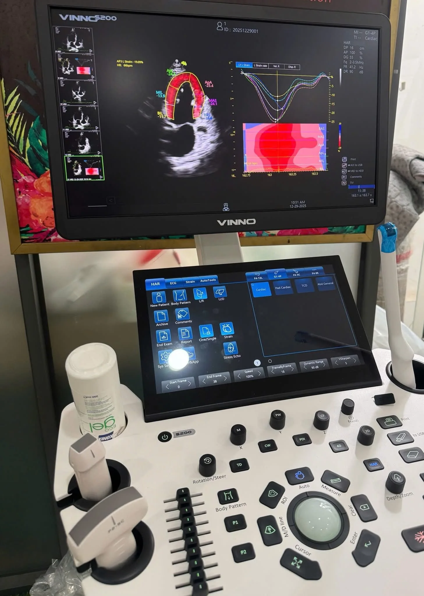 bàn giao máy siêu âm chuyên Tim tại trung tâm Medic Hòa Hảo TP HCM